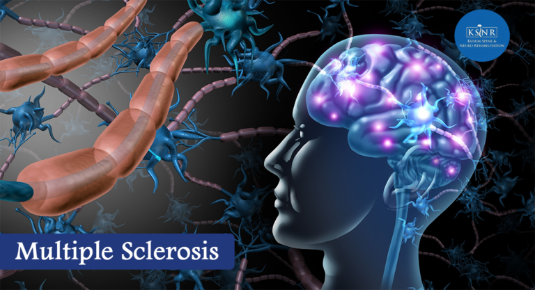 Multiple Sclerosis Therapies 768x417