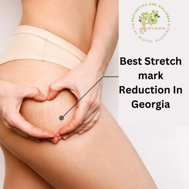 Best Stretch mark Reduction In Georgia 768x768