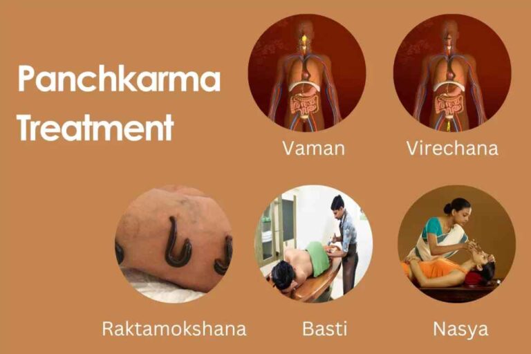 Panchkarma Treatment 1024x682 11zon 768x512