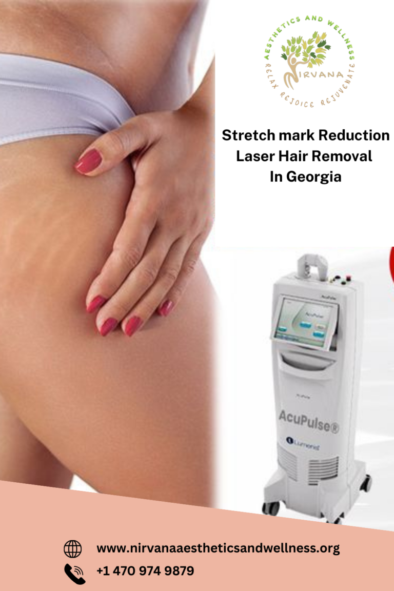 Stretch mark Reduction Laser Hair Removal In Georgia 768x1152