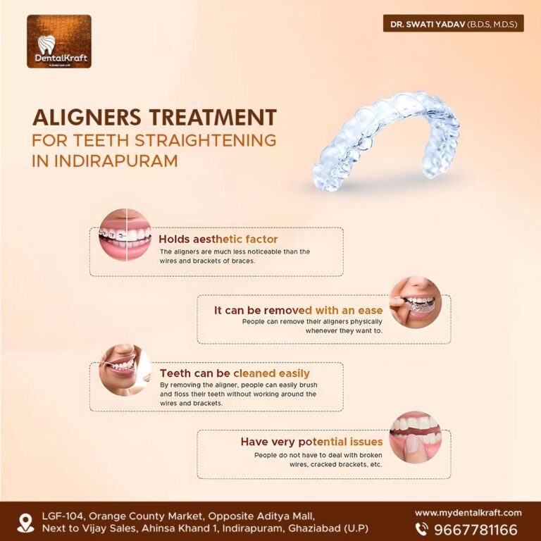 Aligners Treatment for Teeth Straightening in Indirapuram 2 768x768