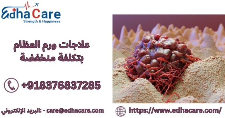 علاجات ورم العظام بتكلفة منخفضة 768x403